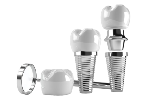 Имплантация